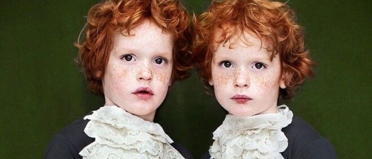the mystery of identical twins | Amsterdam UMC